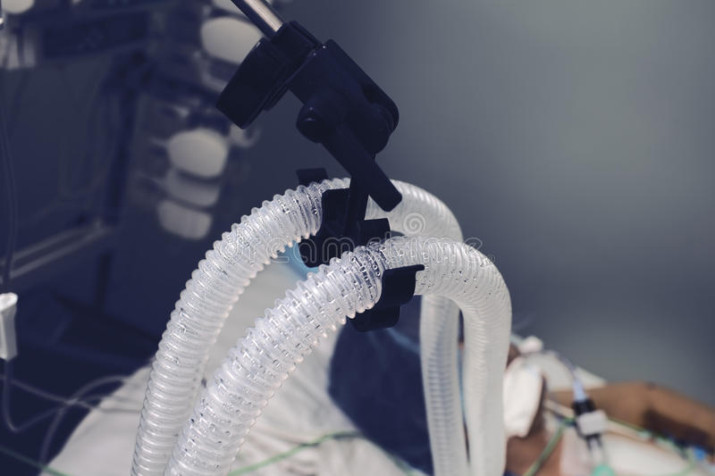 路透社：为应对新冠疫情，英国政府向各公司订购1万台呼吸机
