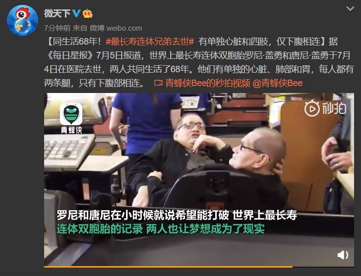 最长寿连体兄弟去世 两人共同生活68年