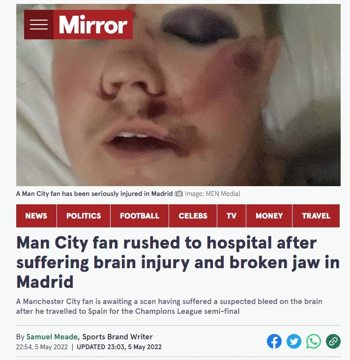 镜报：一曼城球迷在马德里遭到袭击，需接受手术治疗