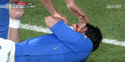 谁是少林足球？02年韩国vs意大利：马尔蒂尼遭爆头、科科血流满面