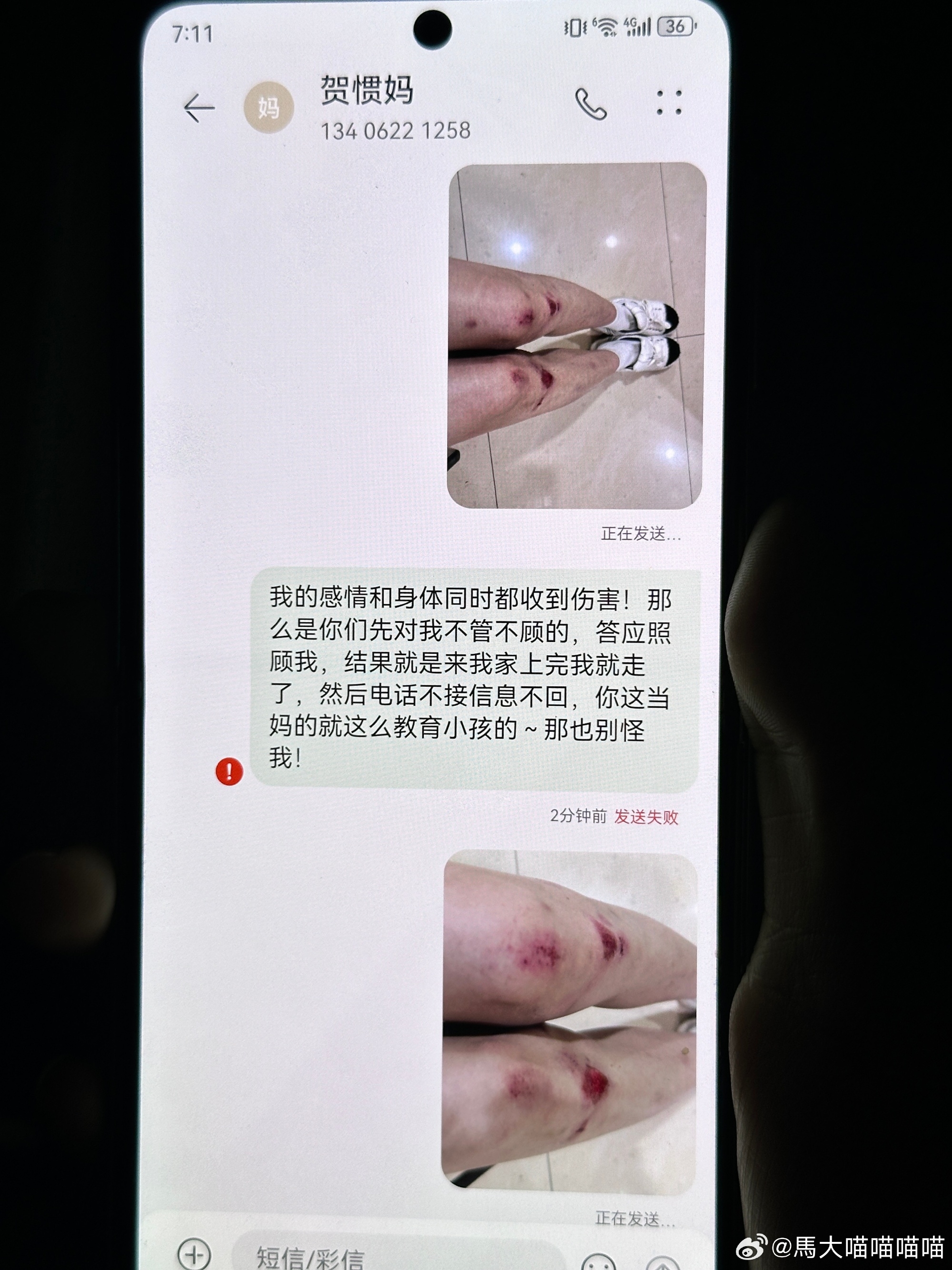 🍉女子再晒受伤照喷贺惯母子：每次说的很好听，但每次都是欺骗