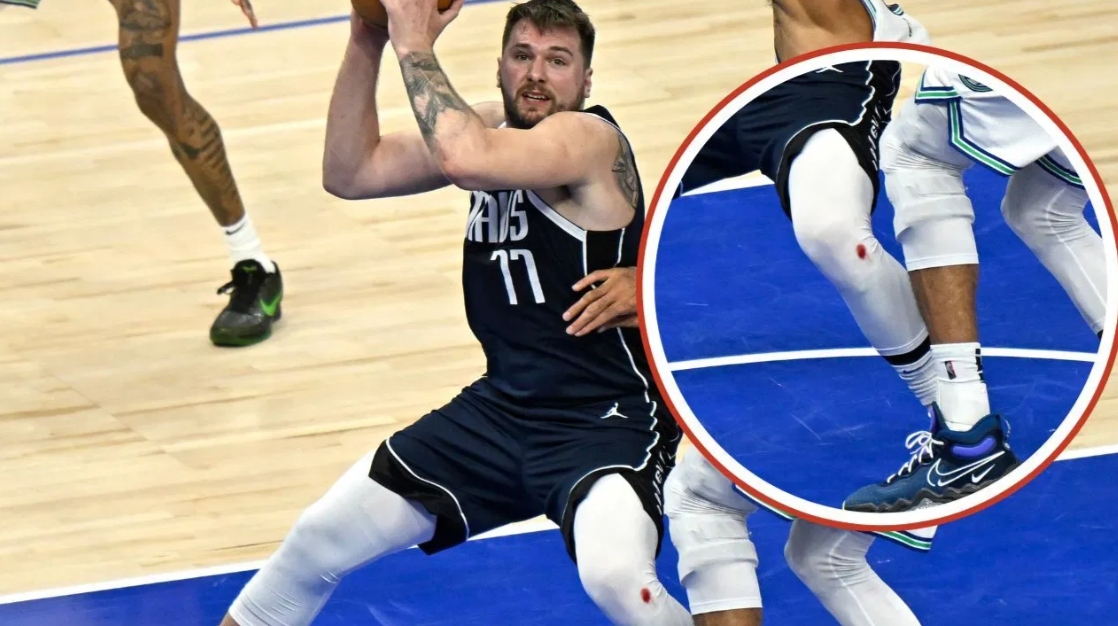 【行业动态】东契奇&库里膝盖出血之谜：不是药水⚽ 而是地板擦伤留下的真实血迹(图6)