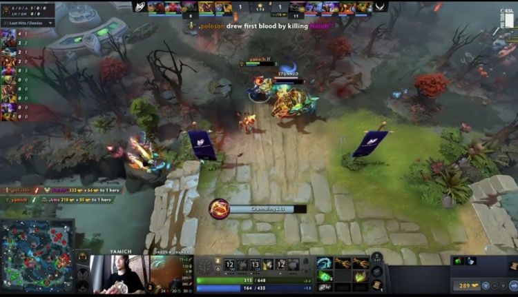 🎮梦幻联赛：苏哥女王超神乱杀 XG放弃治疗光速GG退出舞台