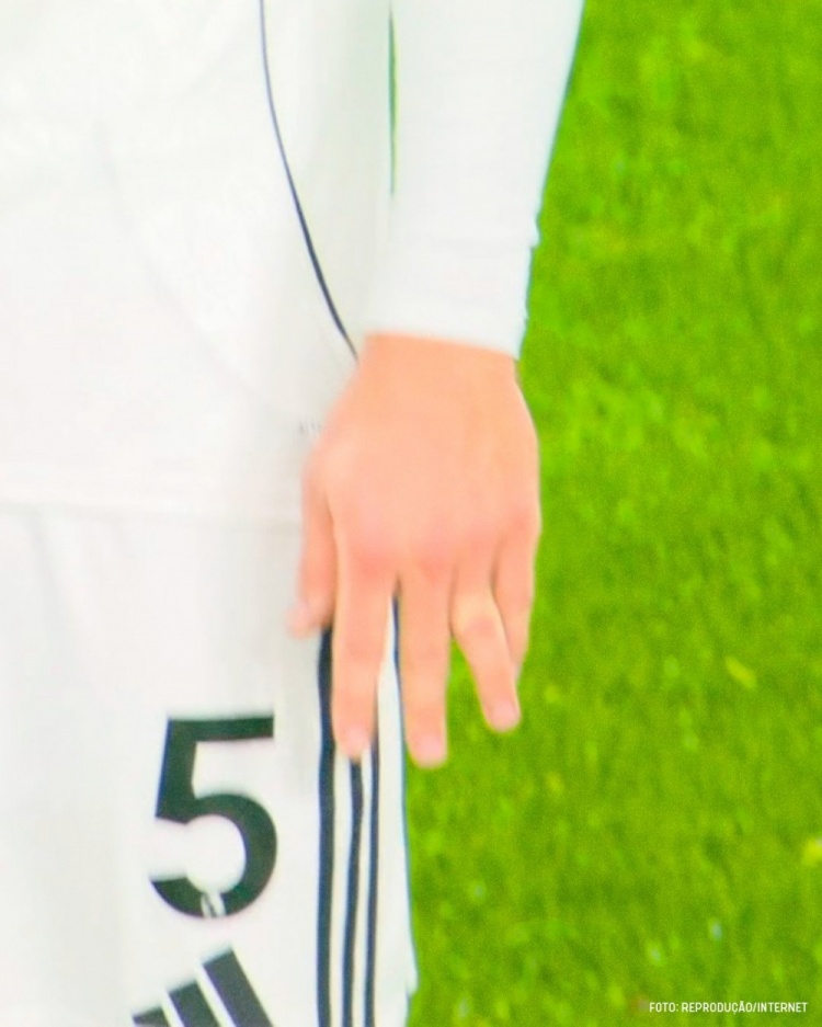 [体育世界]富勒姆后卫比赛中手指脱臼强忍疼痛复位，对手在一旁不忍直视(图2)