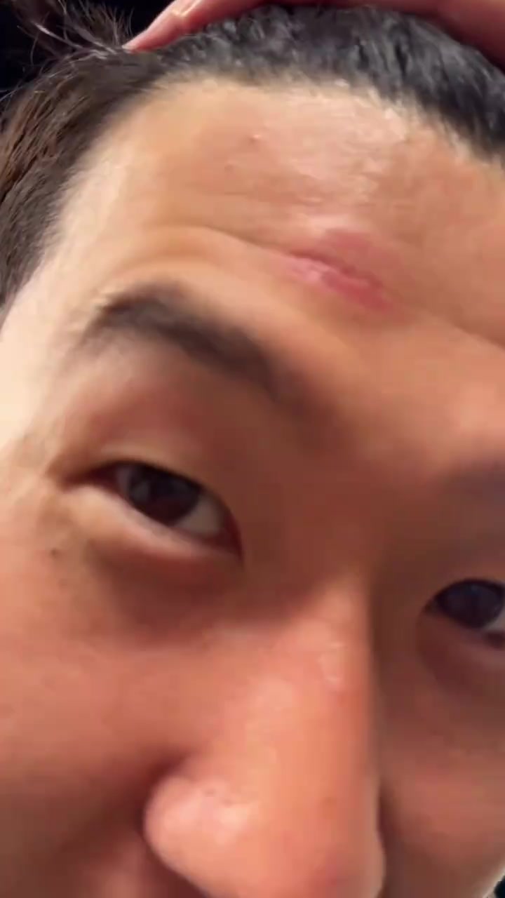 脑门肿了！孙兴慜被人推撞到了奖杯，但