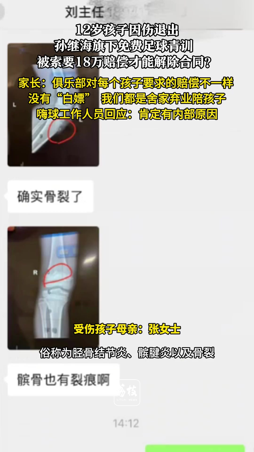 孙继海无辜！你这妈不是因为孩子受伤才退出，而是去当地的俱乐部