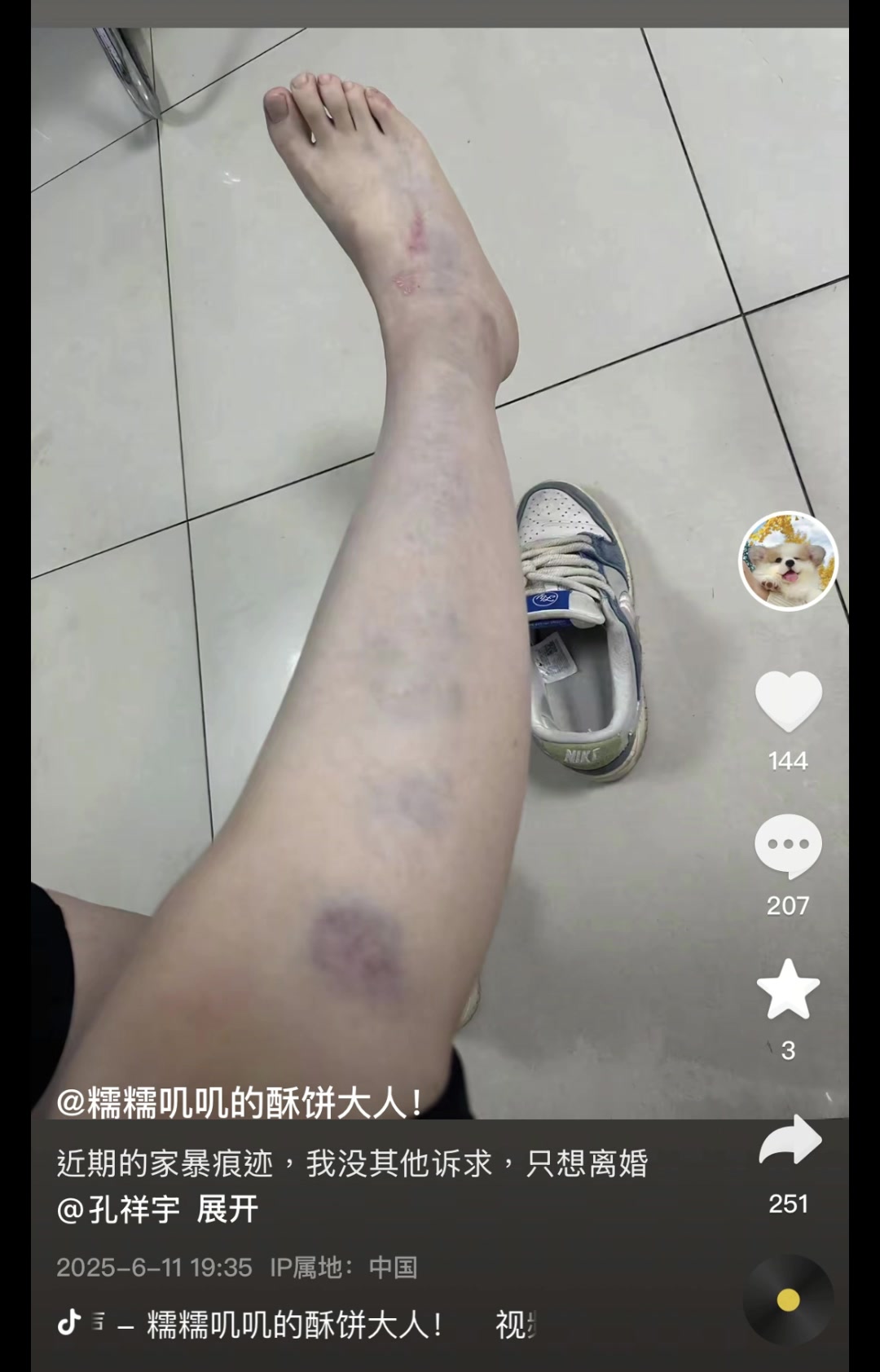 涉及篮球女主播？解说员孔祥宇妻子社媒晒家暴痕迹&申请离婚