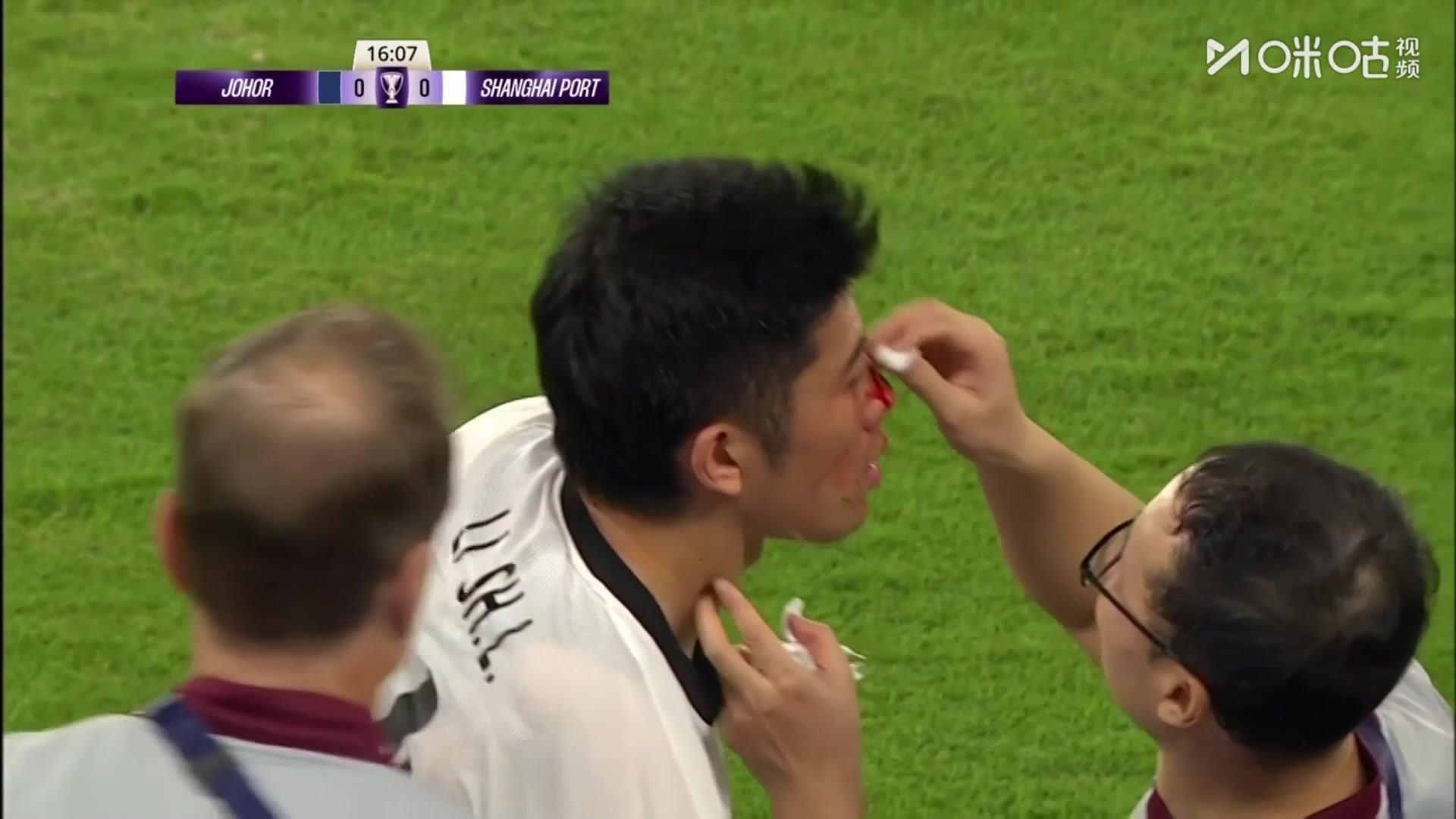 这不给牌？李圣龙倒地被对方重重踢脸血染赛场