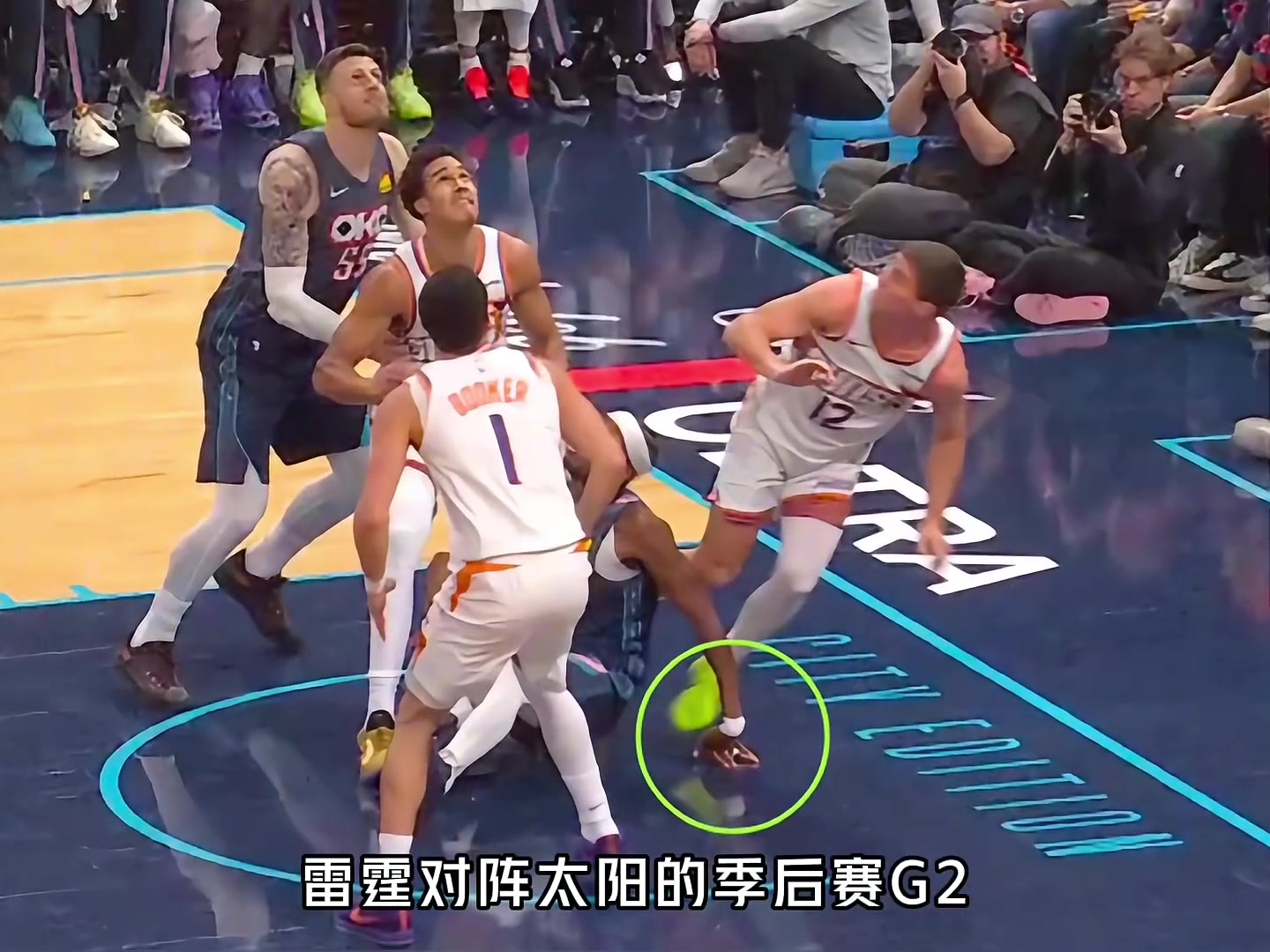 太淡定了！亚历山大手指90°外翻！受伤前5中1受伤后4中4