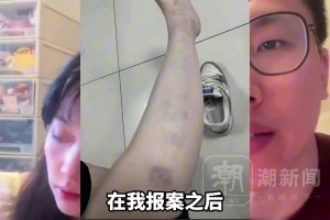 篮球解说孔祥宇被要求离婚，妻子“酥饼”晒腿淤青照称其家暴！