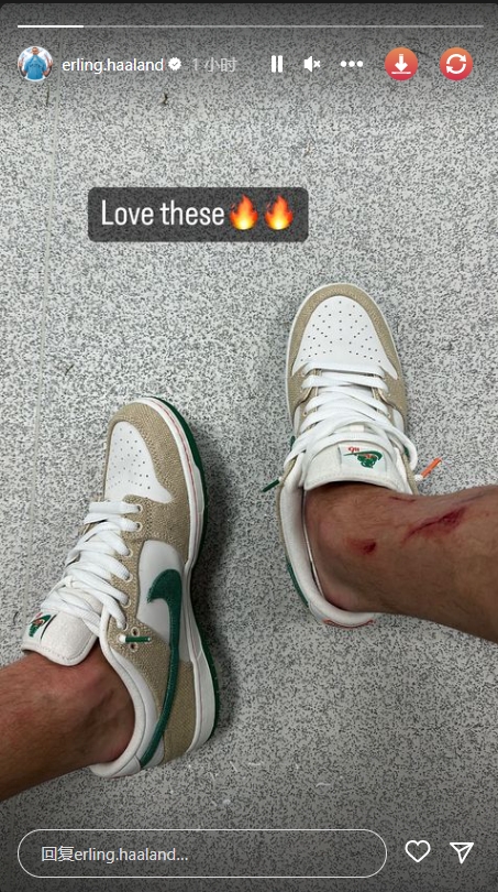 赛后哈兰德更新社媒,他上传了一张自己腿部的照片,腿上有明显的伤口