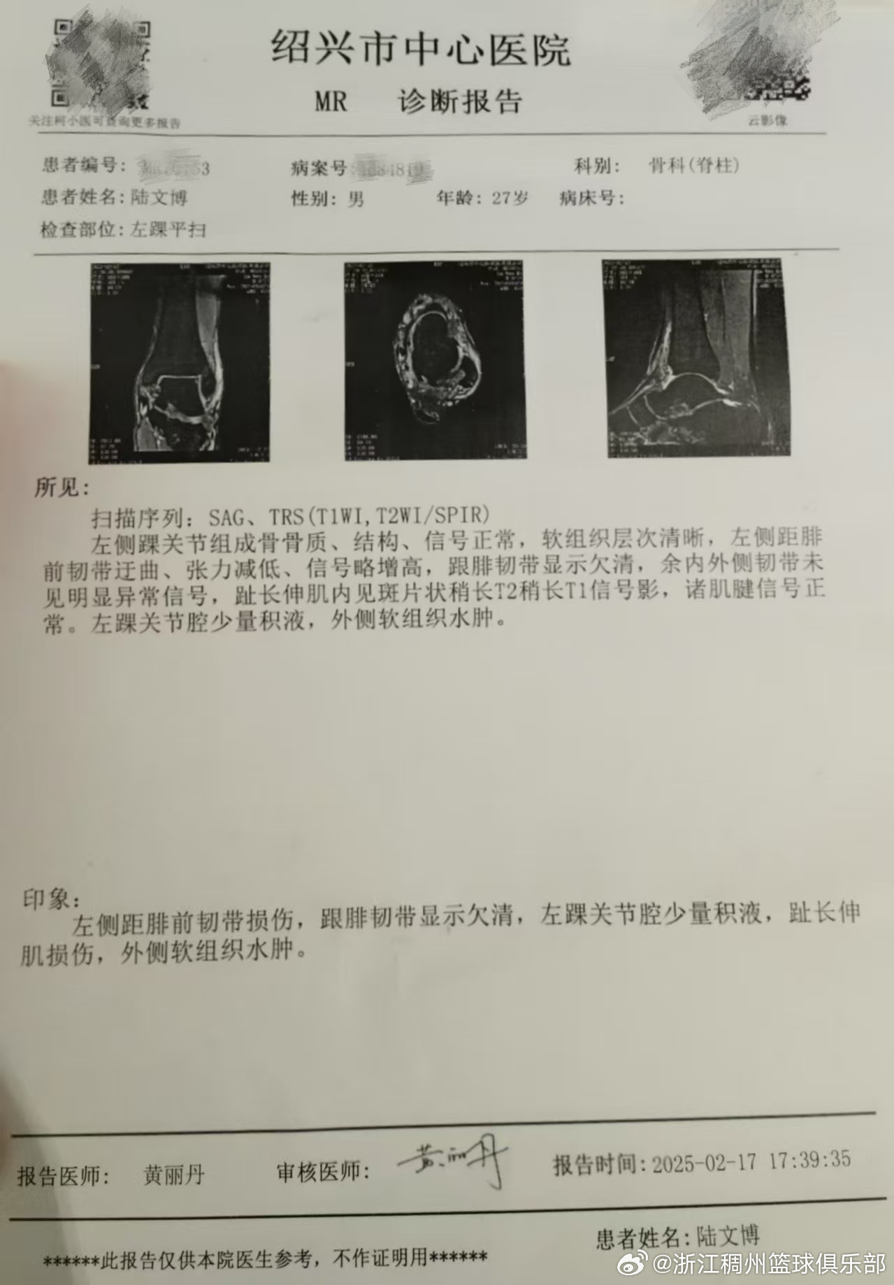 浙江男篮官方：陆文博左侧距腓前韧带损伤 预计需伤停一个月