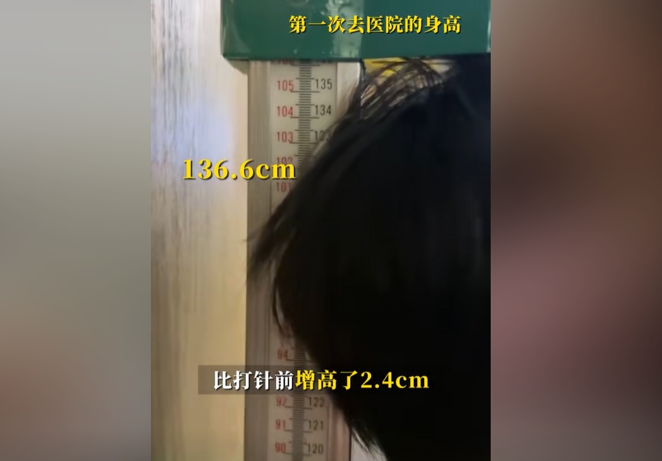 效果真的好吗🤔邹市明妻子：孩子打了3个月生长激素，长了2.4cm