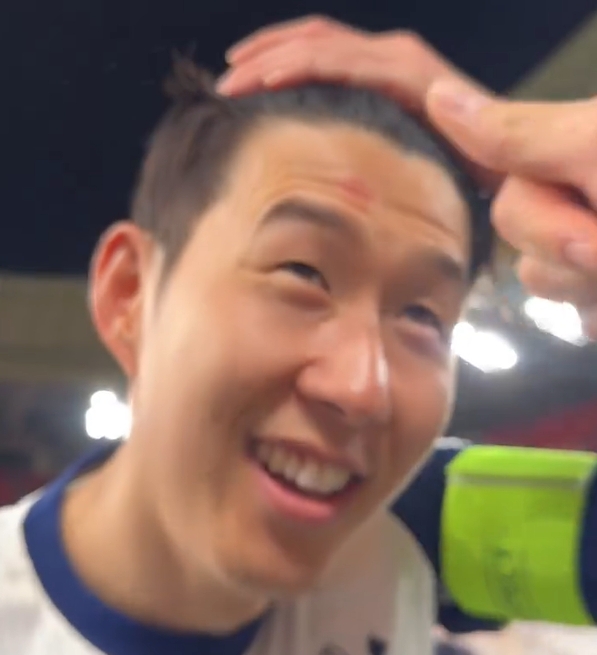 奖杯印记🤣孙兴慜额头挂彩：我捧杯时有人推我，蹭到了奖杯