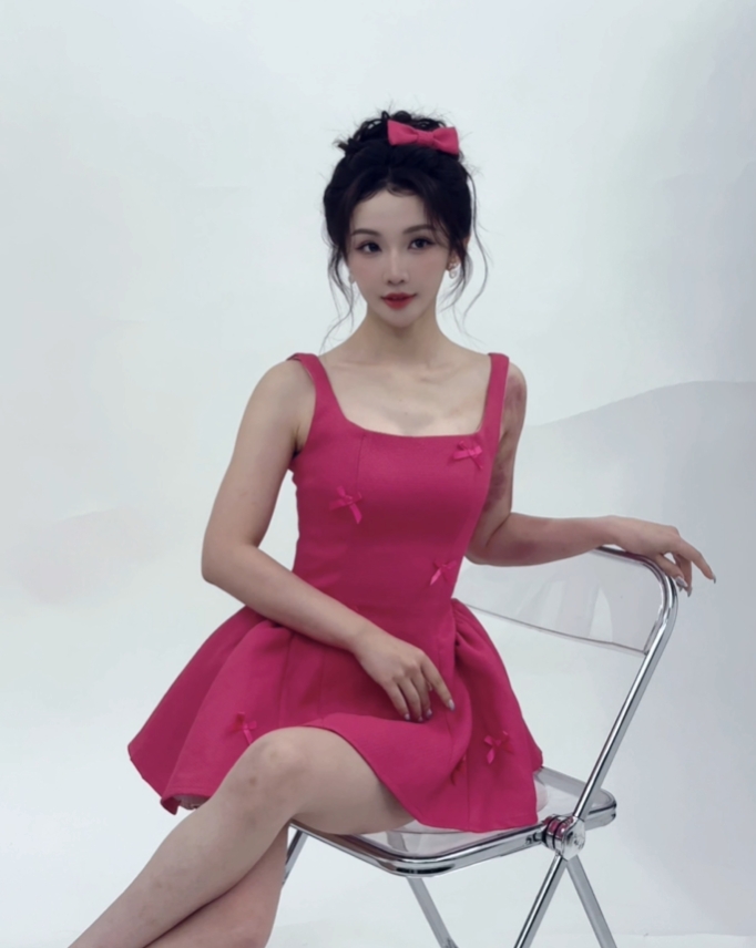 真·战损版·加鹿鹿！解说小鹿晒照：如何呢，那又怎