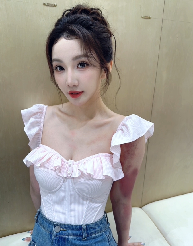 真·战损版·加鹿鹿！解说小鹿晒照：如何呢，那又怎