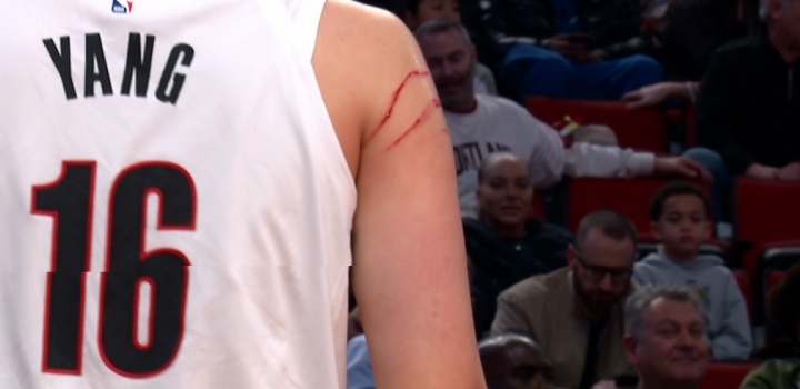 誰干的？給我出來！楊瀚森手臂被抓出了多道血痕！