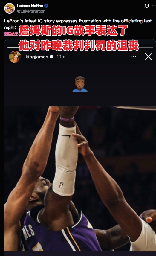 詹姆斯曬被打手美網(wǎng)友炸鍋：借口皇！他甚至裁剪照片掩蓋自己犯規(guī)