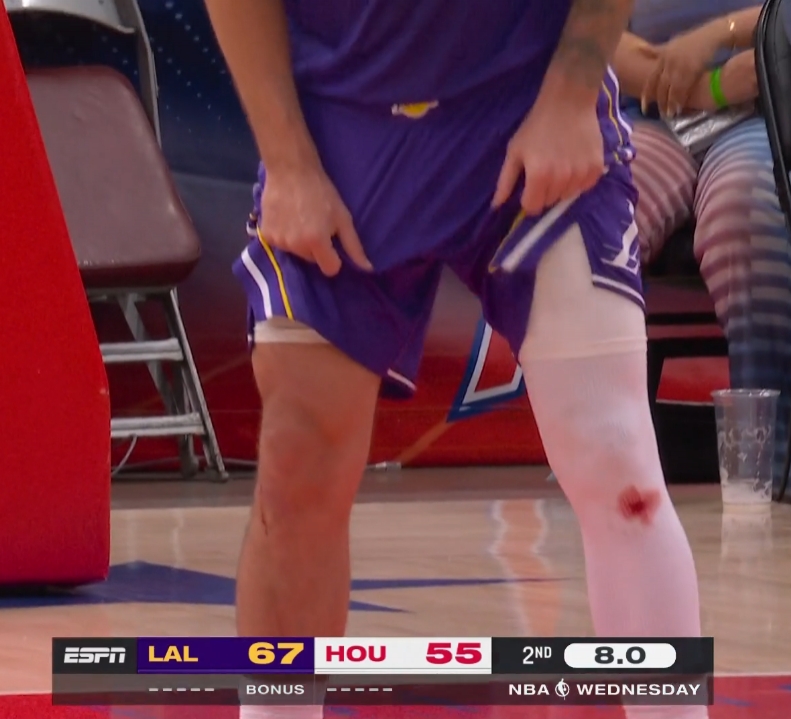 【行业动态】东契奇&库里膝盖出血之谜：不是药水⚽ 而是地板擦