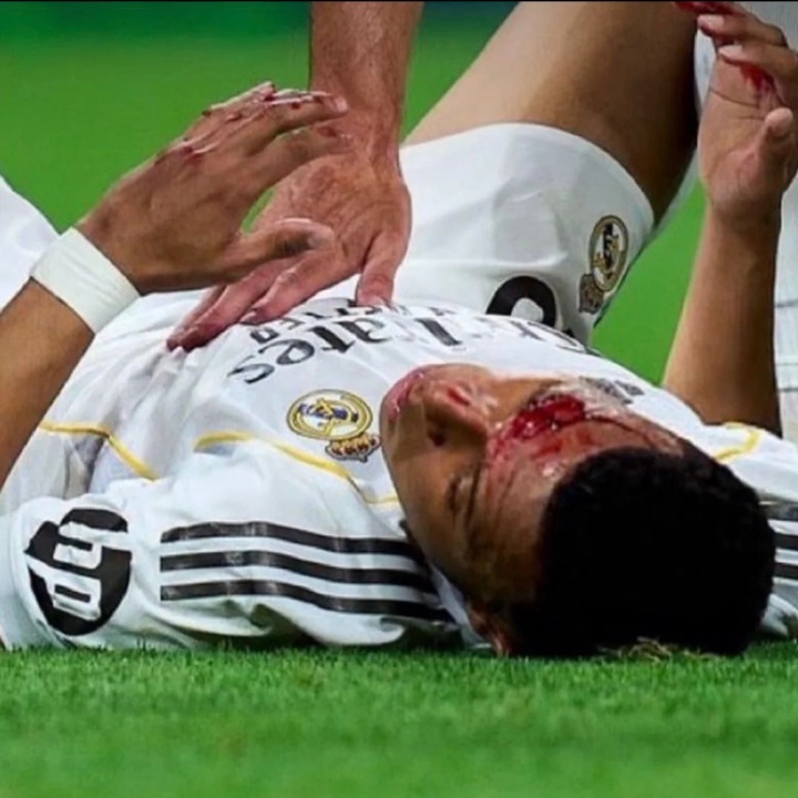 [皇家马德里]龙赛罗晒姆巴佩流血照：这就是西班牙裁判，内格雷拉仍在操控一切(图1)