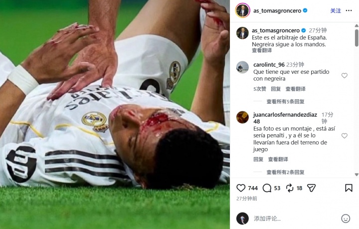 [皇家马德里]龙赛罗晒姆巴佩流血照：这就是西班牙裁判，内格雷拉仍在操控一切(图2)