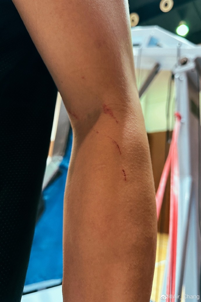 手臂伤痕累累常林晒训练照打铁还需自身硬无须扬鞭自奋蹄