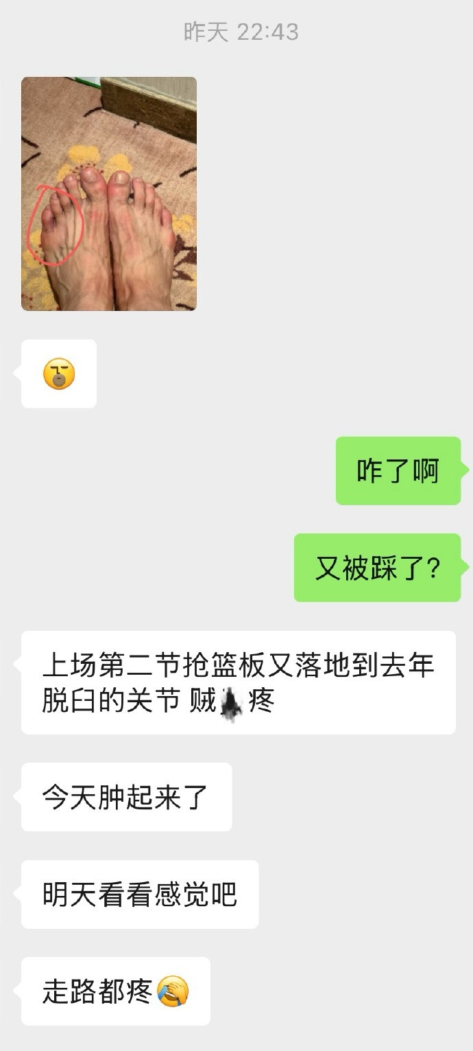 谈球吧(中国)官方网站薛思佳：李弘权上一场伤到去年脱臼的脚趾关节 今天吃止疼药出战