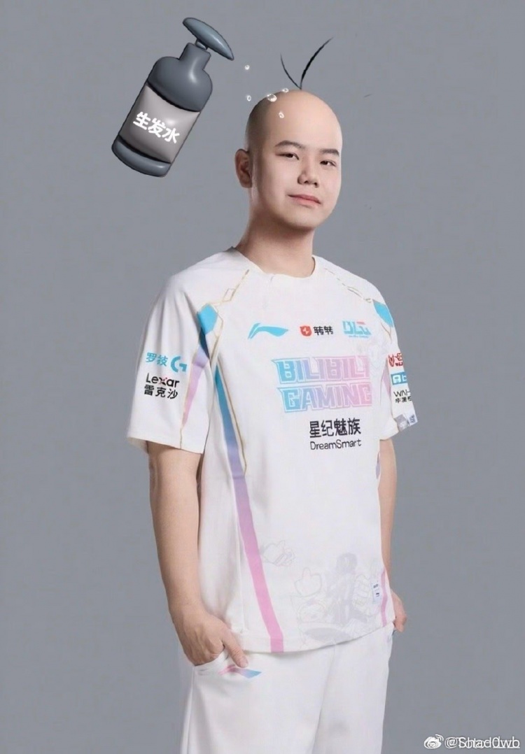 shad0w分享光頭生發(fā)圖：為了我的頭發(fā)我會(huì)繼續(xù)加油的