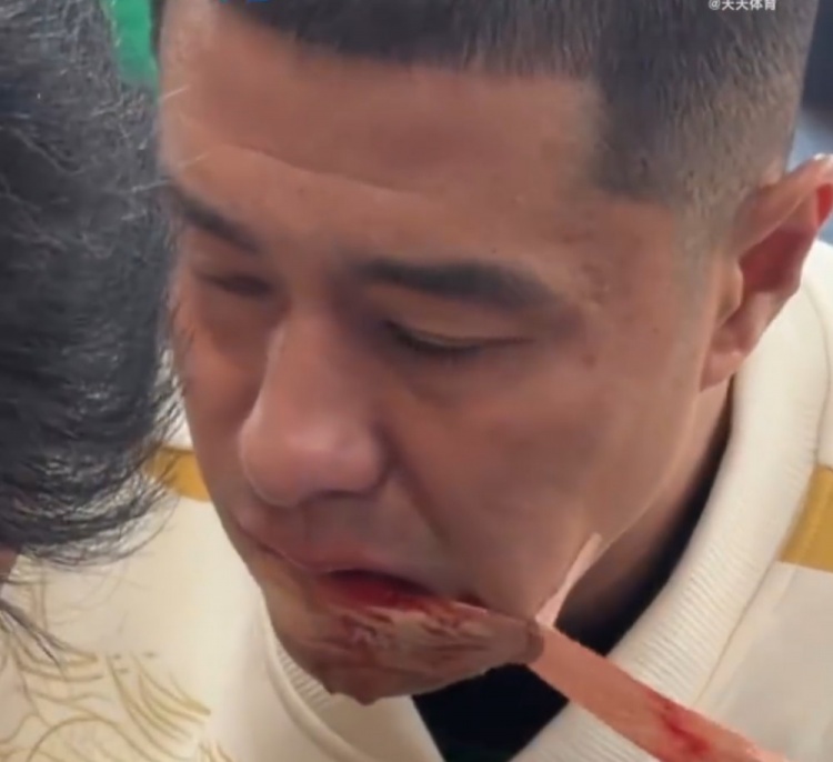 硬汉！国安足协杯夺冠后，侯森在场边默默处理嘴部伤口