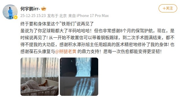 [赛场播报]⬆️何宇鹏社媒晒摘除左足钢板照：终于和身体里这个