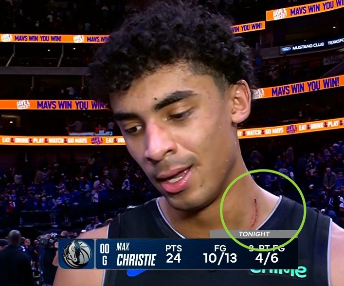 對抗拉滿&強(qiáng)度太大！克里斯蒂的脖子上有明顯的傷痕