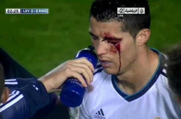 [足球]莱万特旧将：我过去曾无意肘击C罗，媒体却几乎要把我关