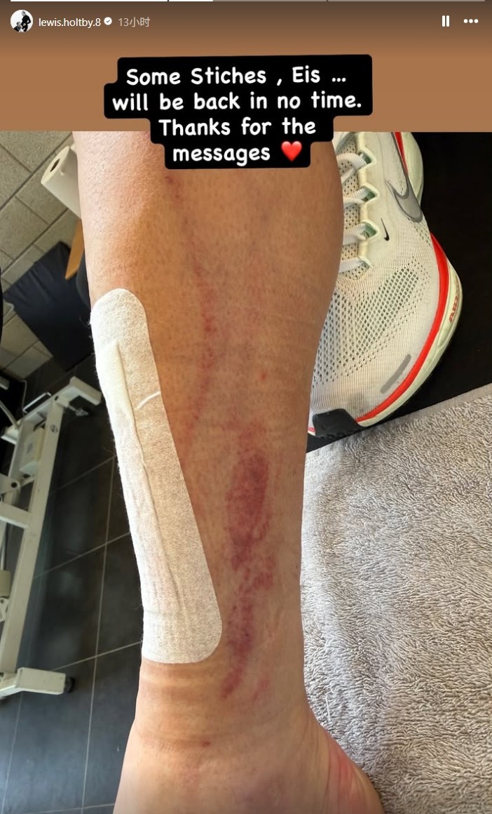 【热点直击】慎入！前德✨甲球员霍尔特比荷甲遭遇⭐凶狠犯规，脚