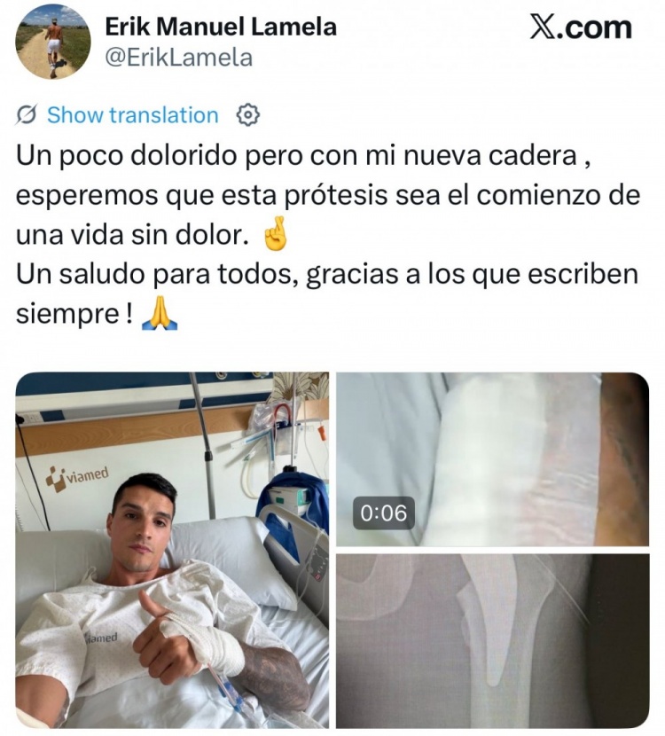 [赛事追踪]前热刺前锋拉梅拉晒换人工髋关节照，球员长期受伤病困扰去年退❕役(图1)