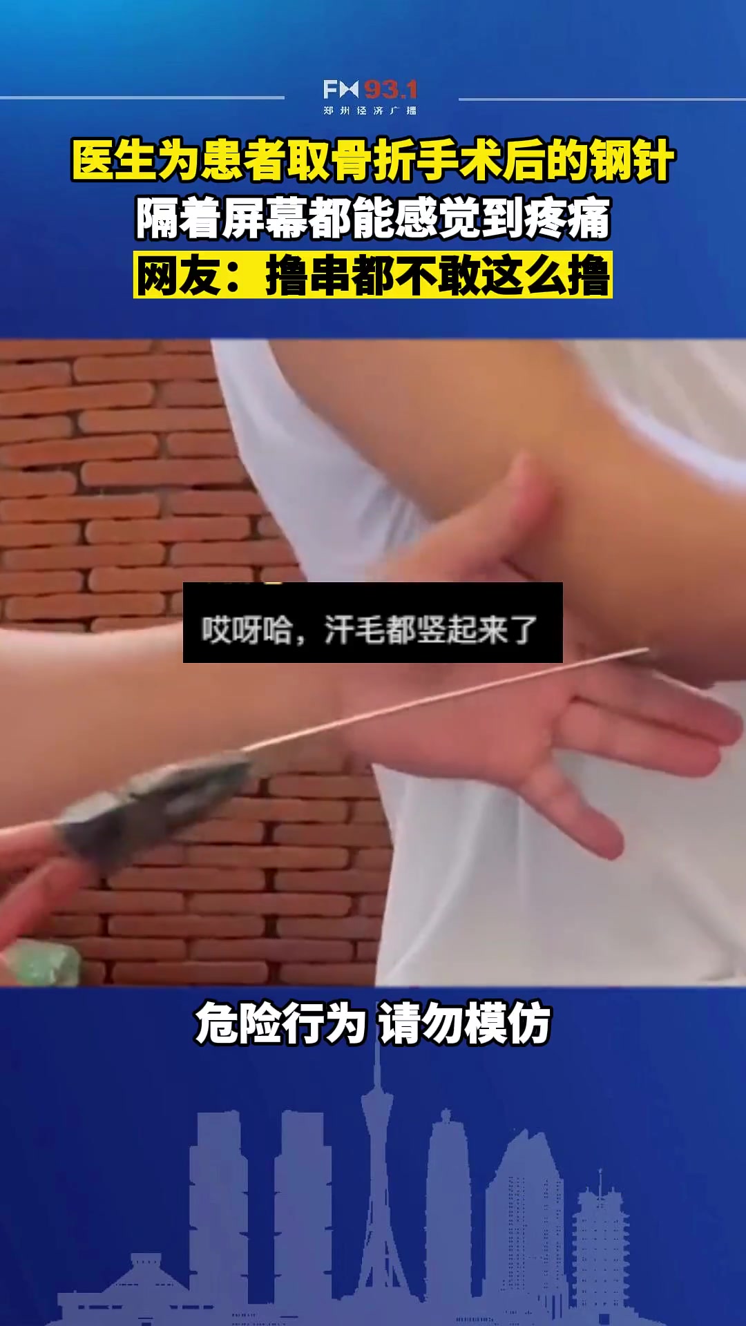 这样取钢针吗?撸串都不带这么丝滑,隔着屏幕都感觉疼!-直播吧