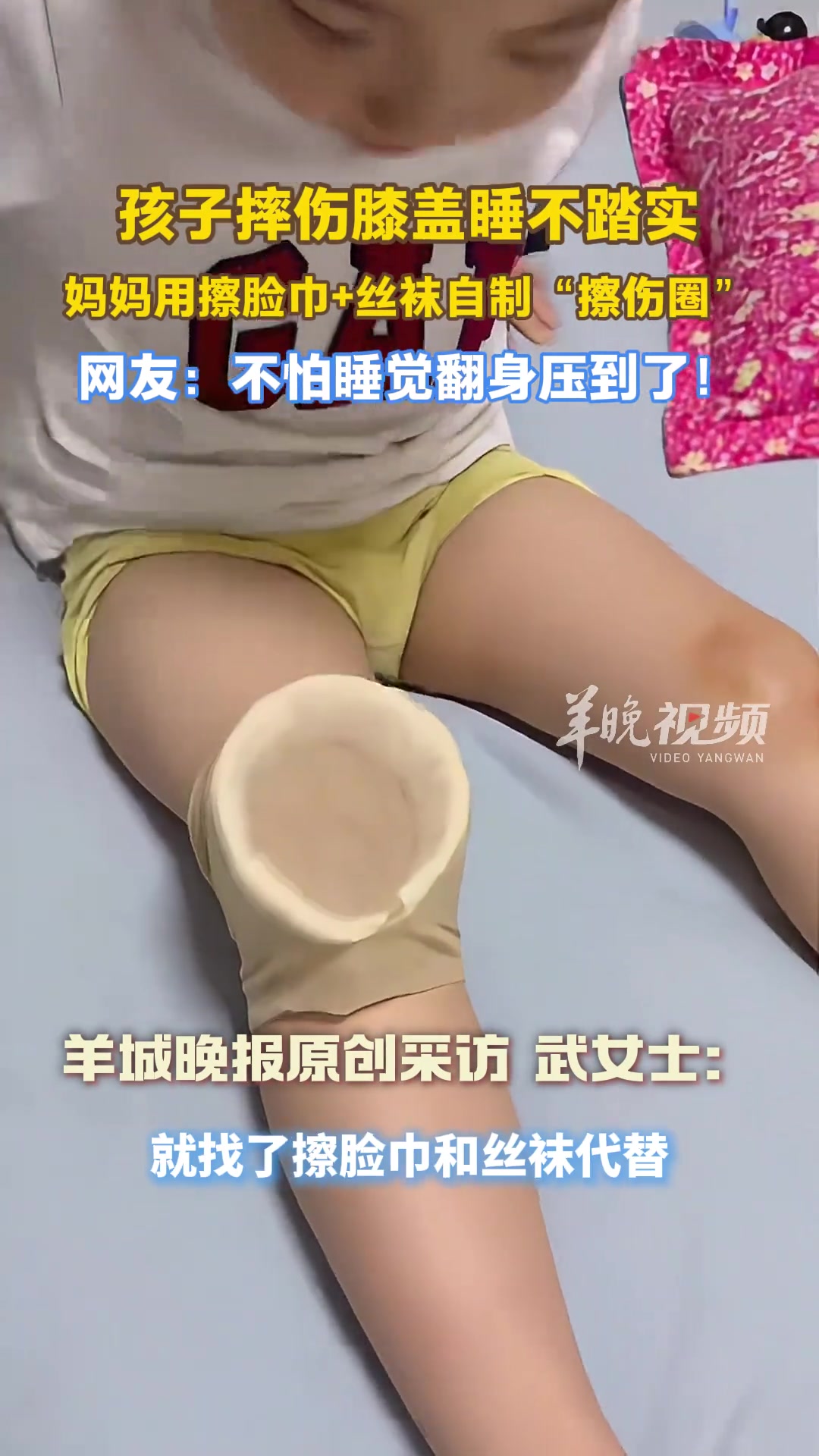 孩子摔伤膝盖睡不踏实妈妈用擦脸巾+丝袜自制“擦伤圈”