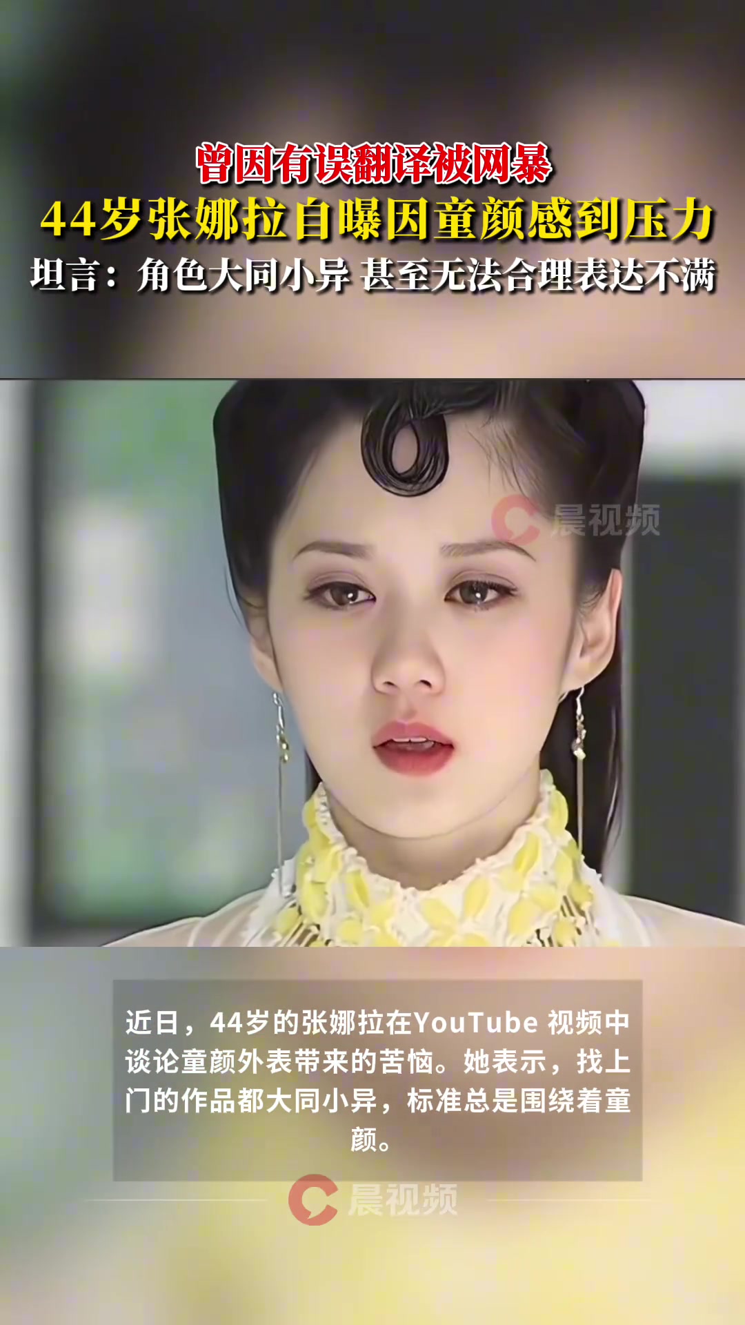 44岁张娜拉自曝因童颜感到压力，遭受职业与心理的双重困扰