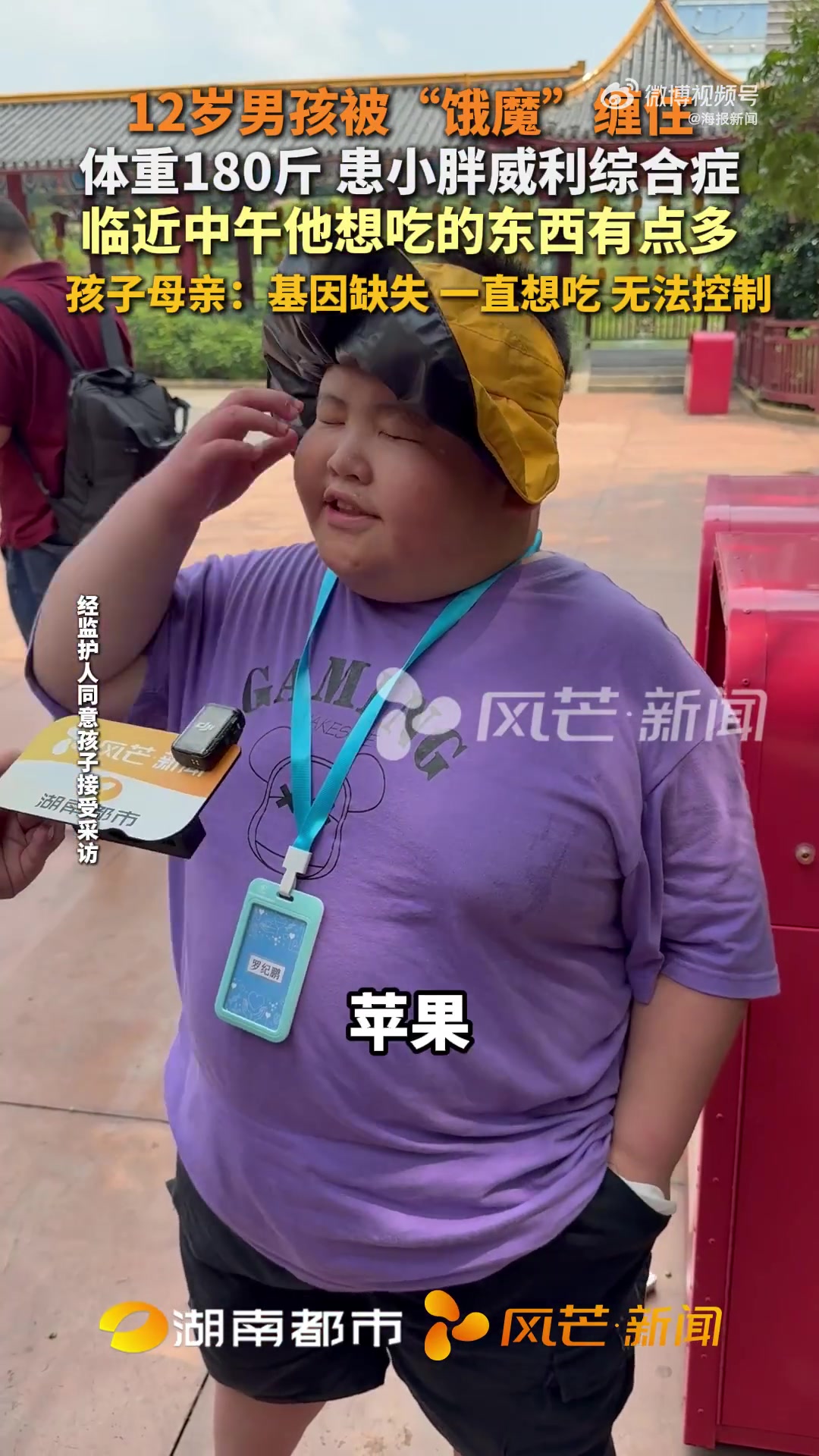 12岁男孩患小胖威利综合征！