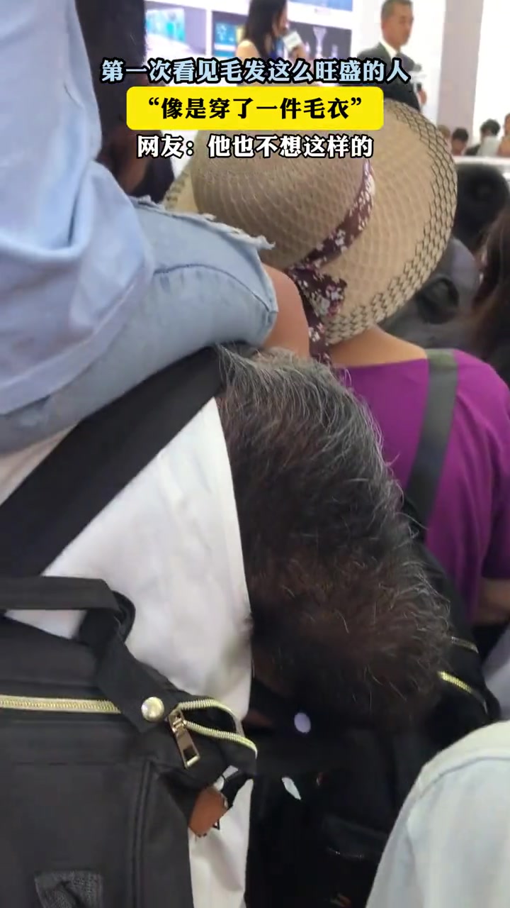 第一次看见毛发这么旺盛的人,像是穿了一件毛衣