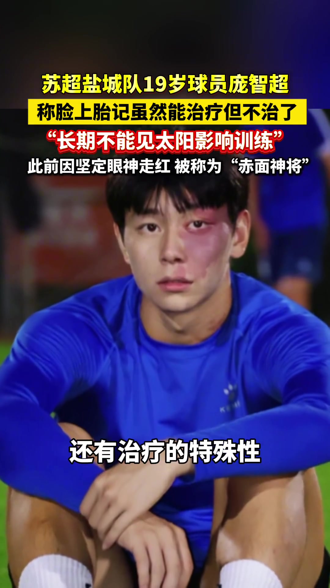[体育视频]苏超盐城队“赤面神将”庞智超谈脸上胎记：能治疗，