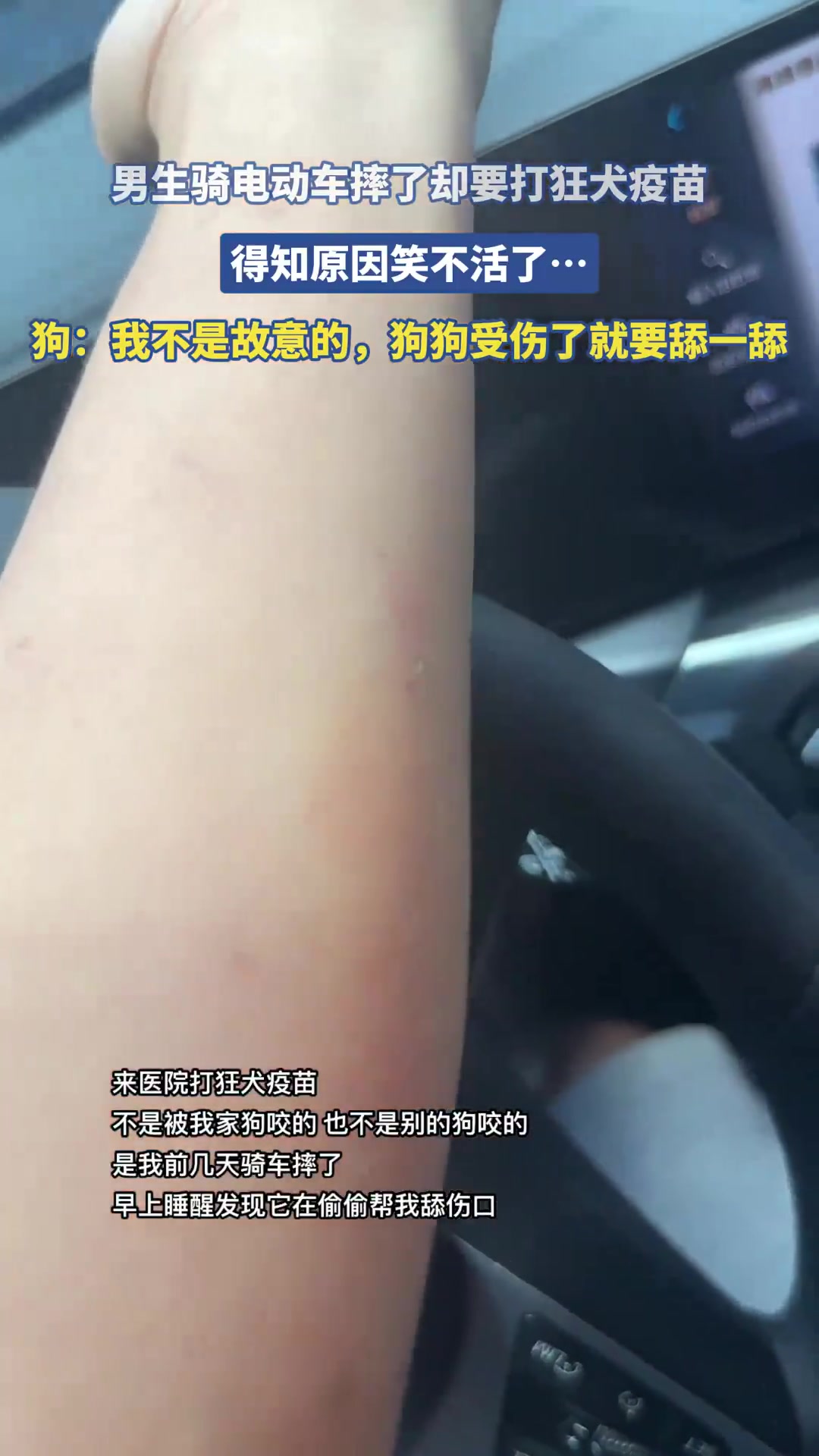 男生骑电动车摔了却要打狂犬疫苗，得知原因笑不活了！