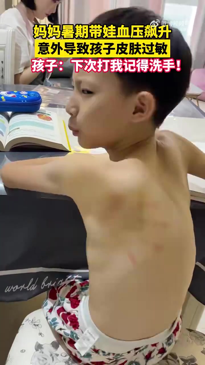 孩子暑假不寫作業(yè)，媽媽拍了一下，竟意外導致過敏