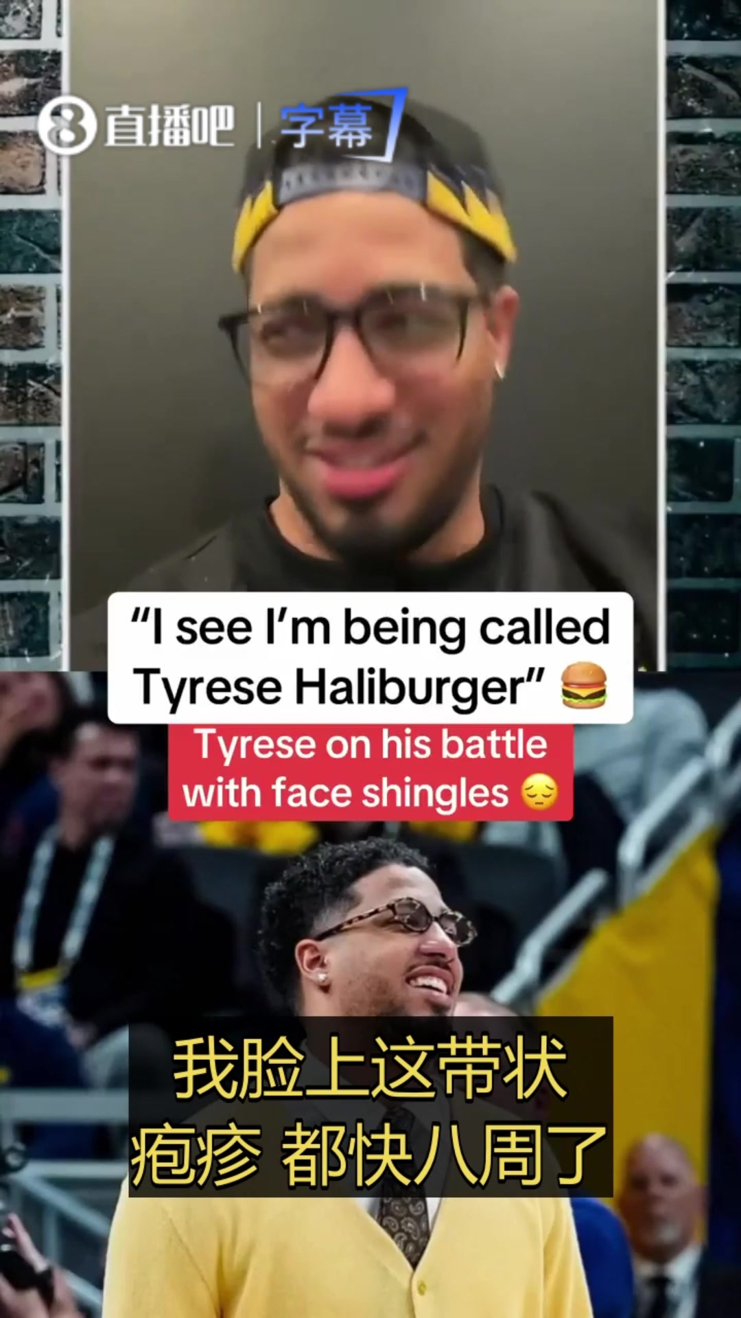 【哈利伯顿】哈利伯顿：治带状疱疹的药有副作用，让我变胖，现在