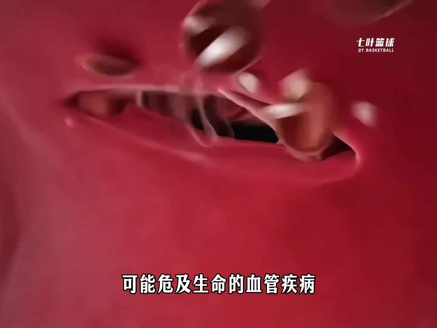 【关键对位视频】血栓痊愈后到少林寺修行➡️ 文班亚马仿佛打通